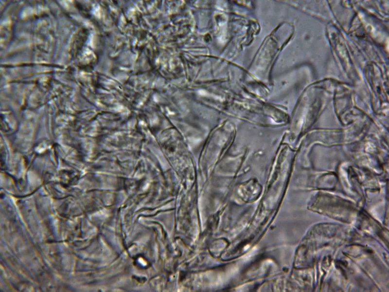 Caloboletus radicans 10 - Pileipellis agua